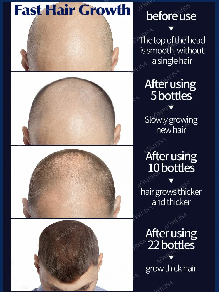 Hair Growth Solution – Fight Baldness & Hair Loss