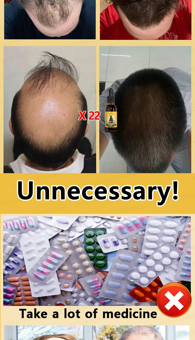 Hair Growth Solution – Fight Baldness & Hair Loss