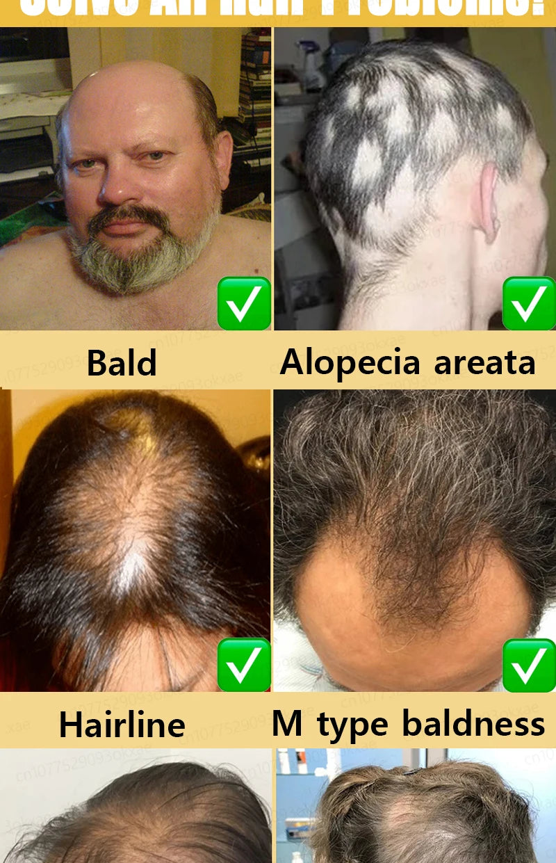 Hair Growth Solution – Fight Baldness & Hair Loss