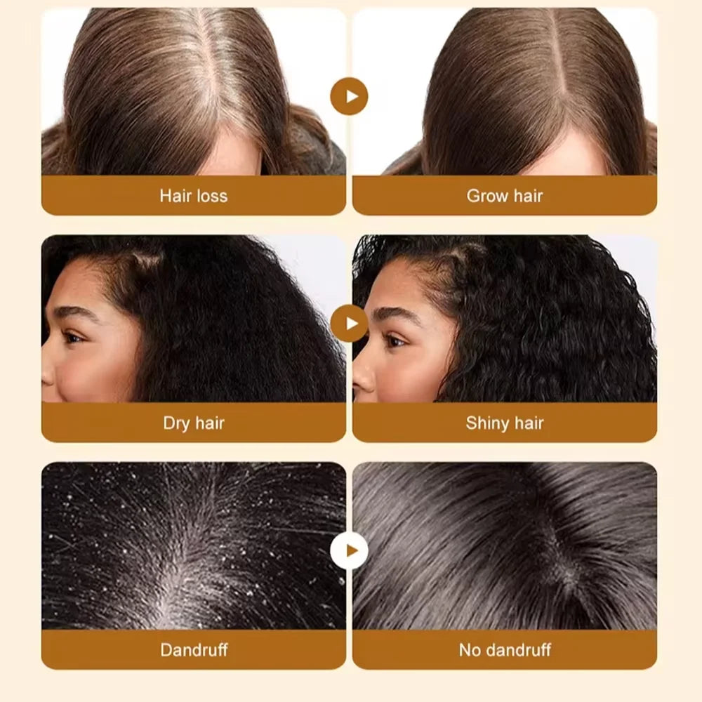 Fast Hair Growth Set – Batana Oil Treatment