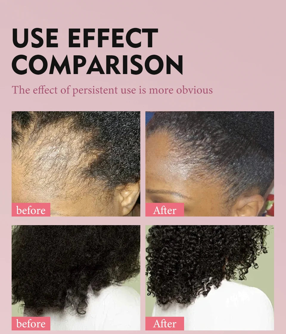 Fast Hair Growth Set – Batana Oil Treatment