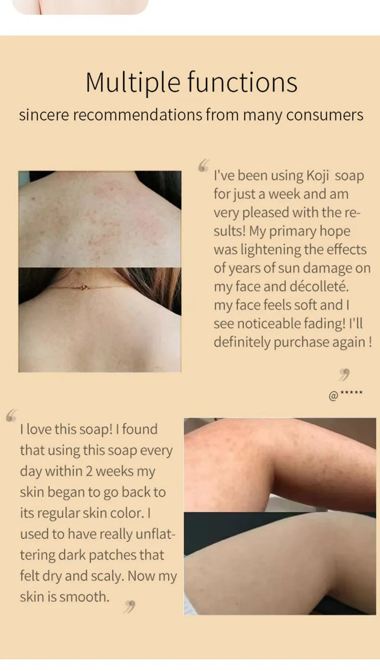 Handmade Kojic Acid Whitening Soap