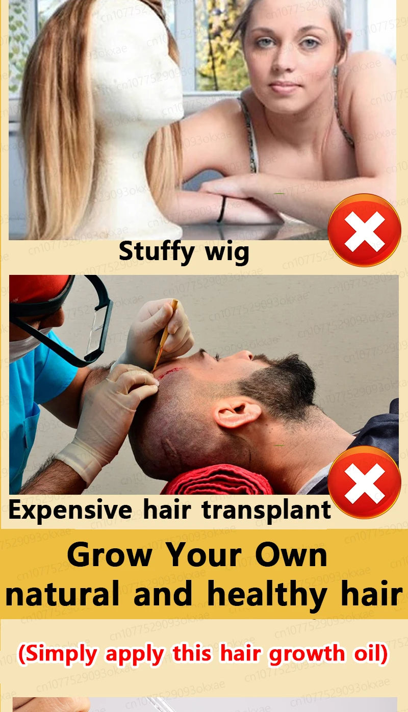 WPRBREGT Hair Growth Essential Oil