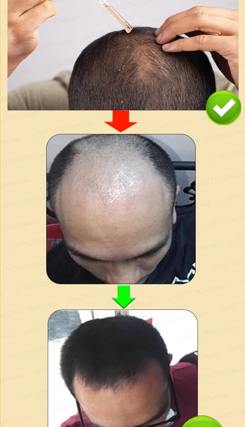Hair Growth Solution – Fight Baldness & Hair Loss