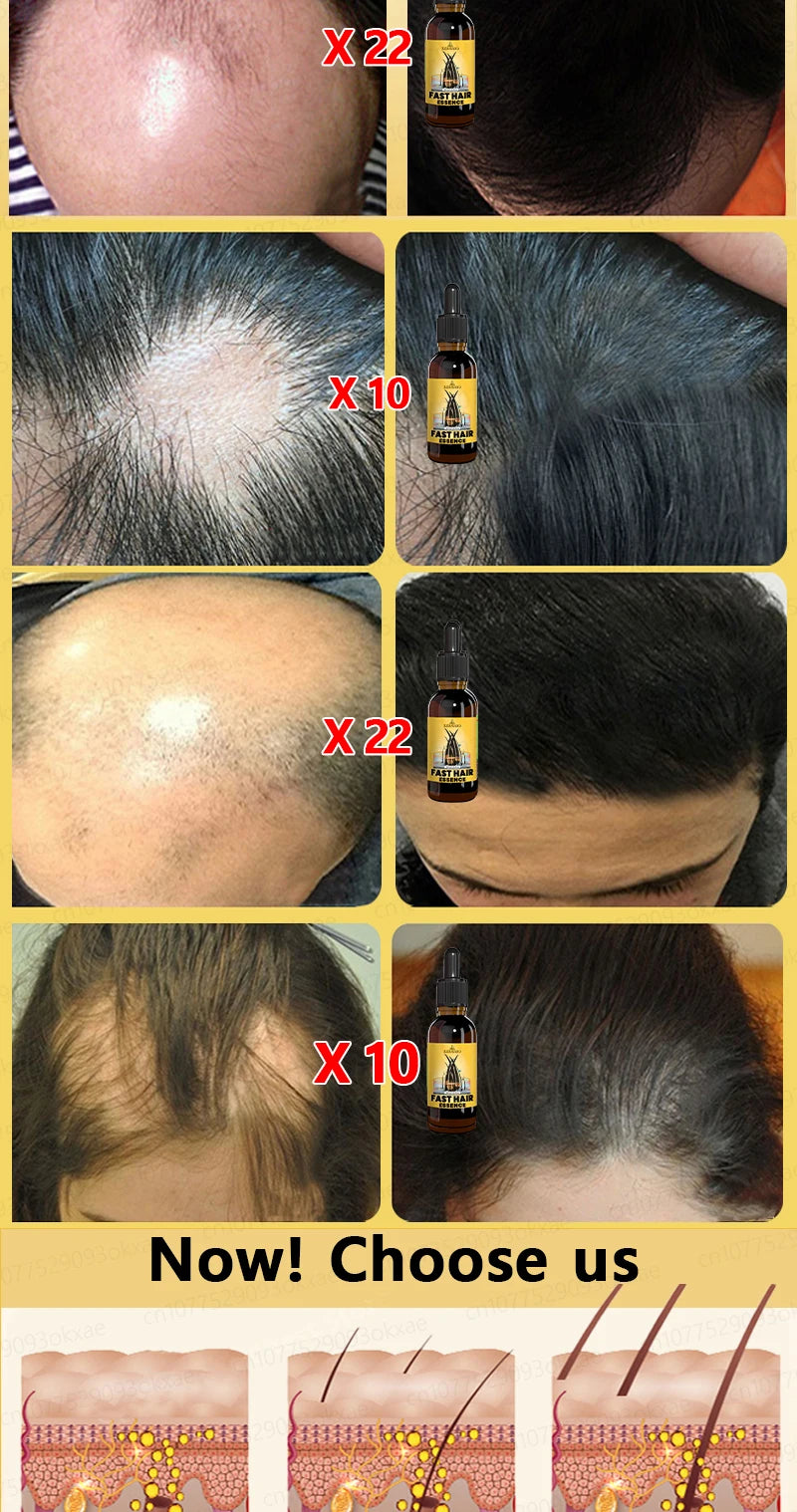 Hair Growth Solution – Fight Baldness & Hair Loss