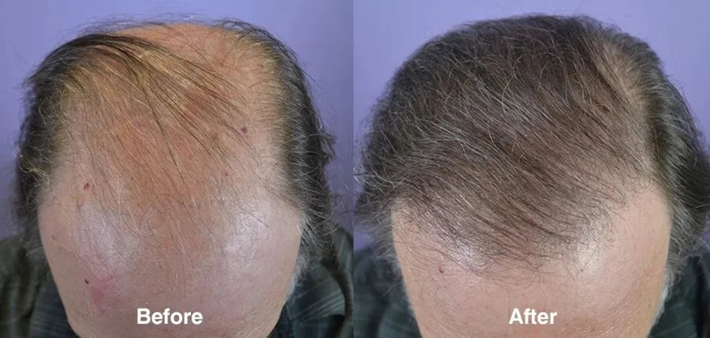 Ginger Hair Root & Scalp Treatment Oil