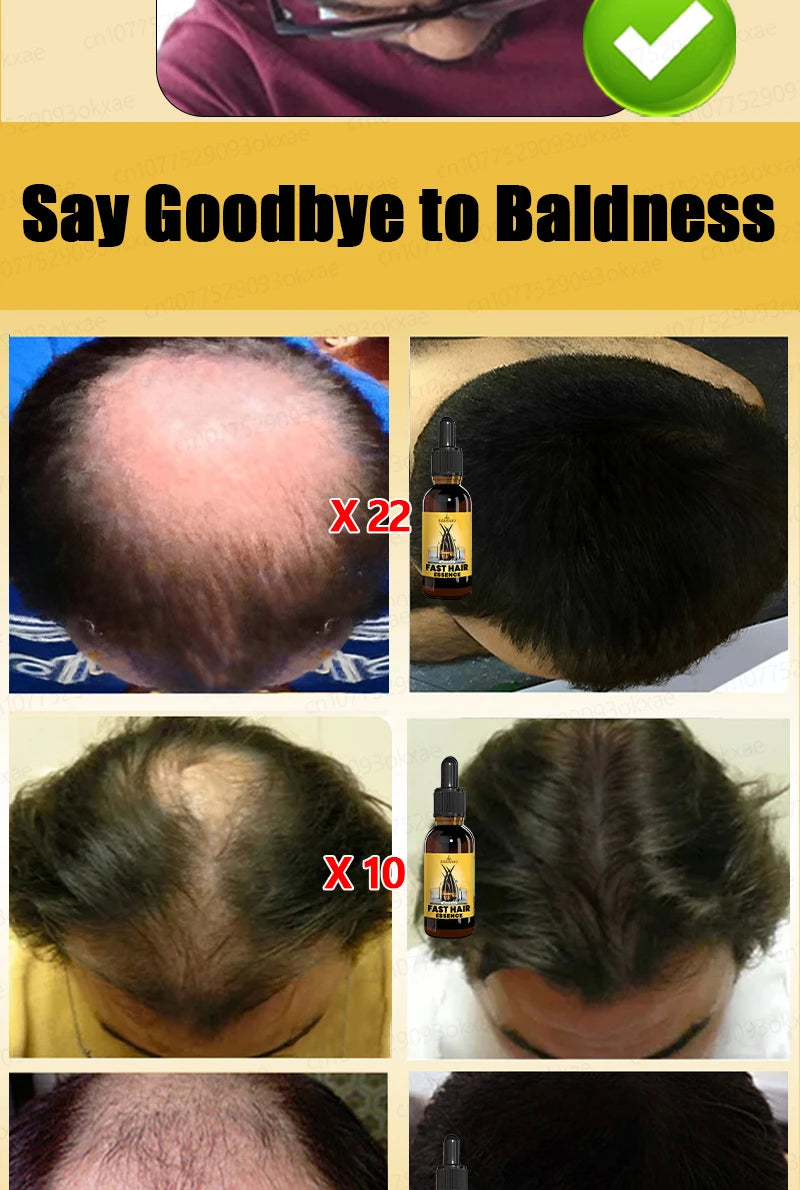 Hair Growth Solution – Fight Baldness & Hair Loss
