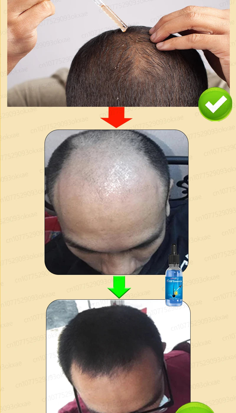 WPRBREGT Hair Growth Essential Oil