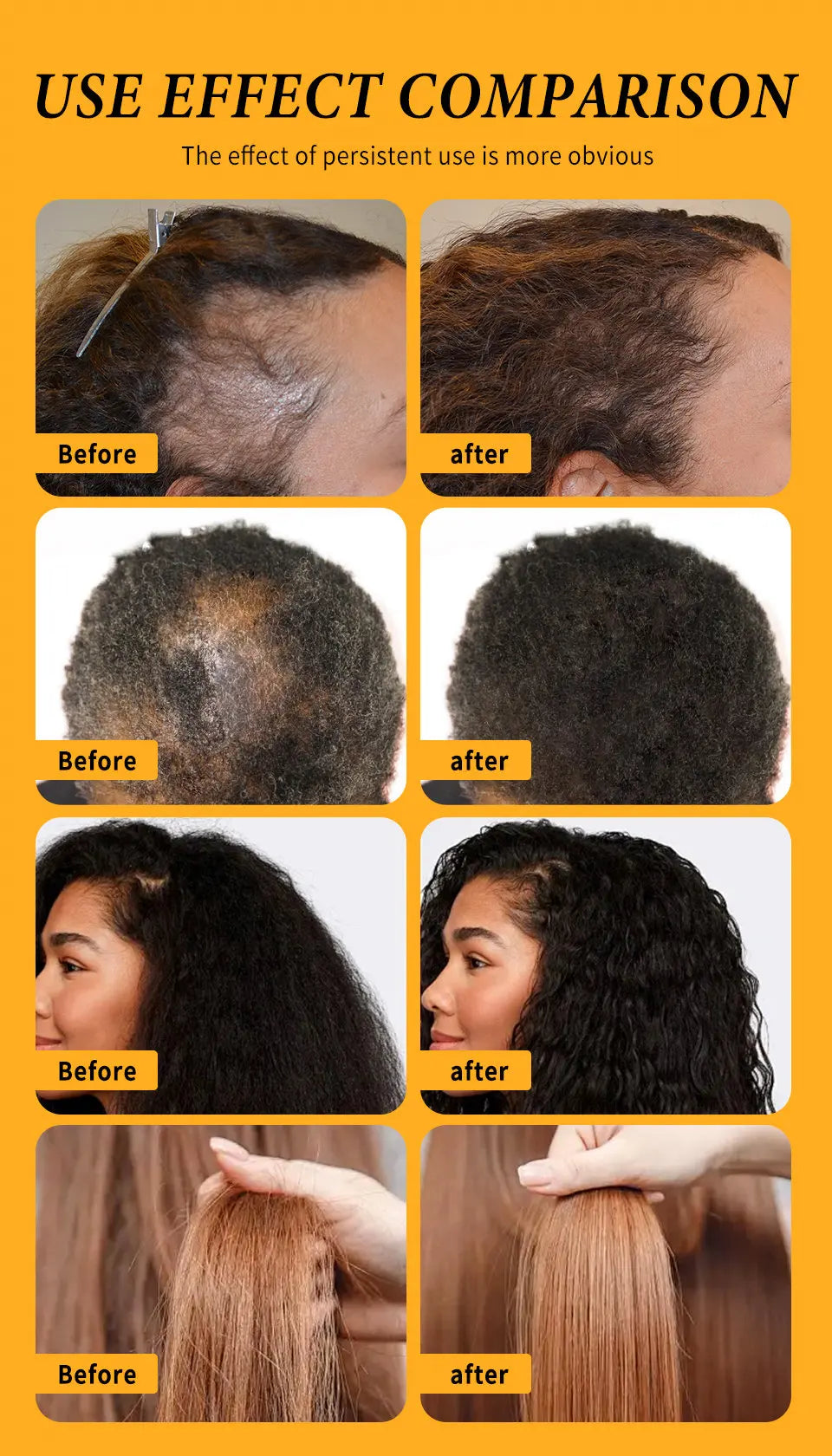Fast Hair Growth Set – Batana Oil Treatment