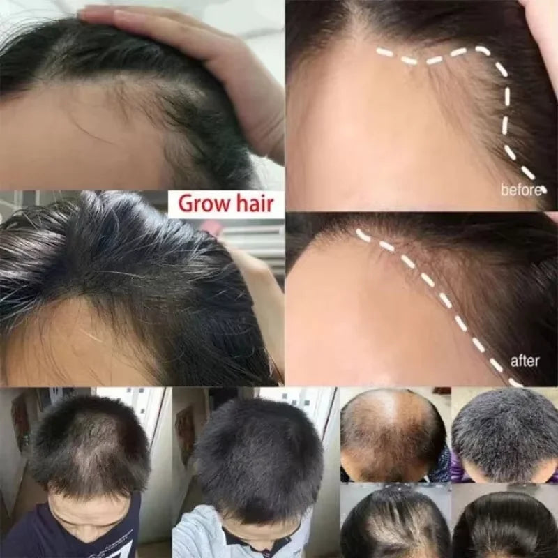 Fast Hair Growth Set – Batana Oil Treatment