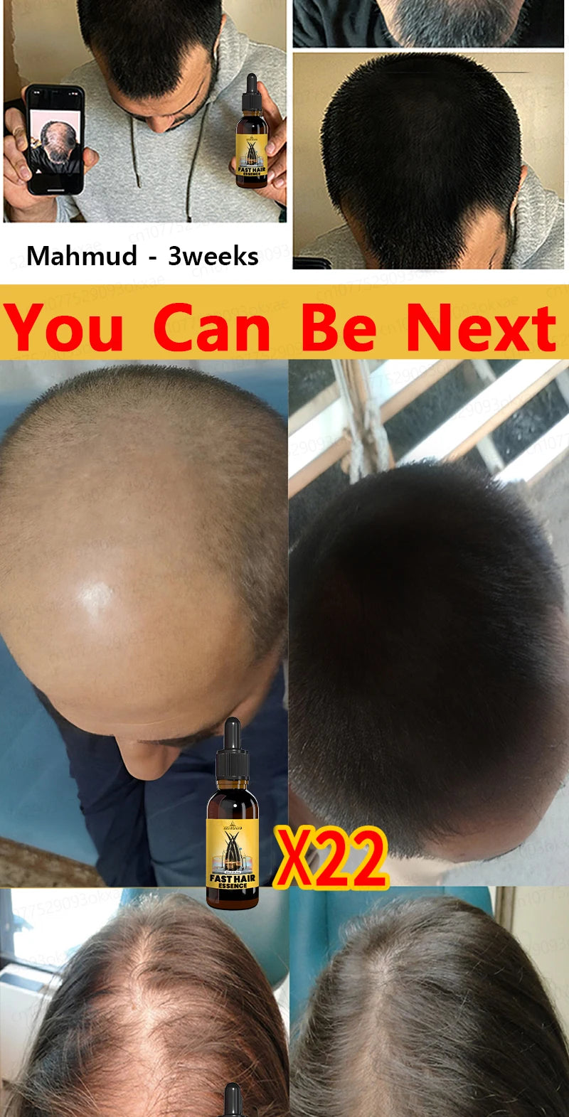 Hair Growth Solution – Fight Baldness & Hair Loss