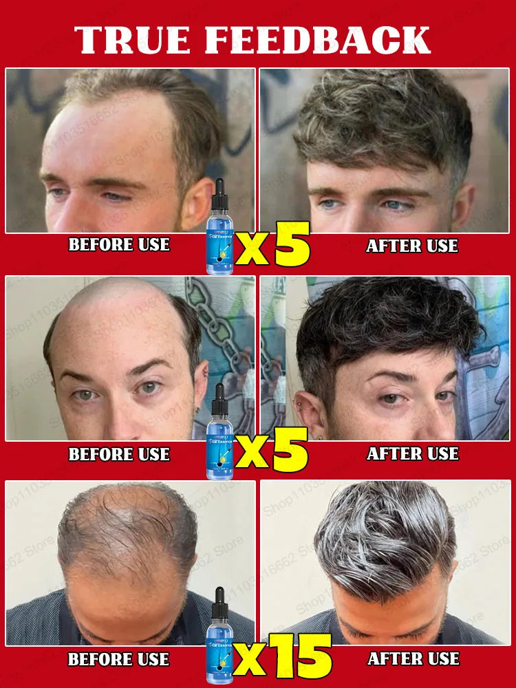 WPRBREGT Hair Growth Essential Oil