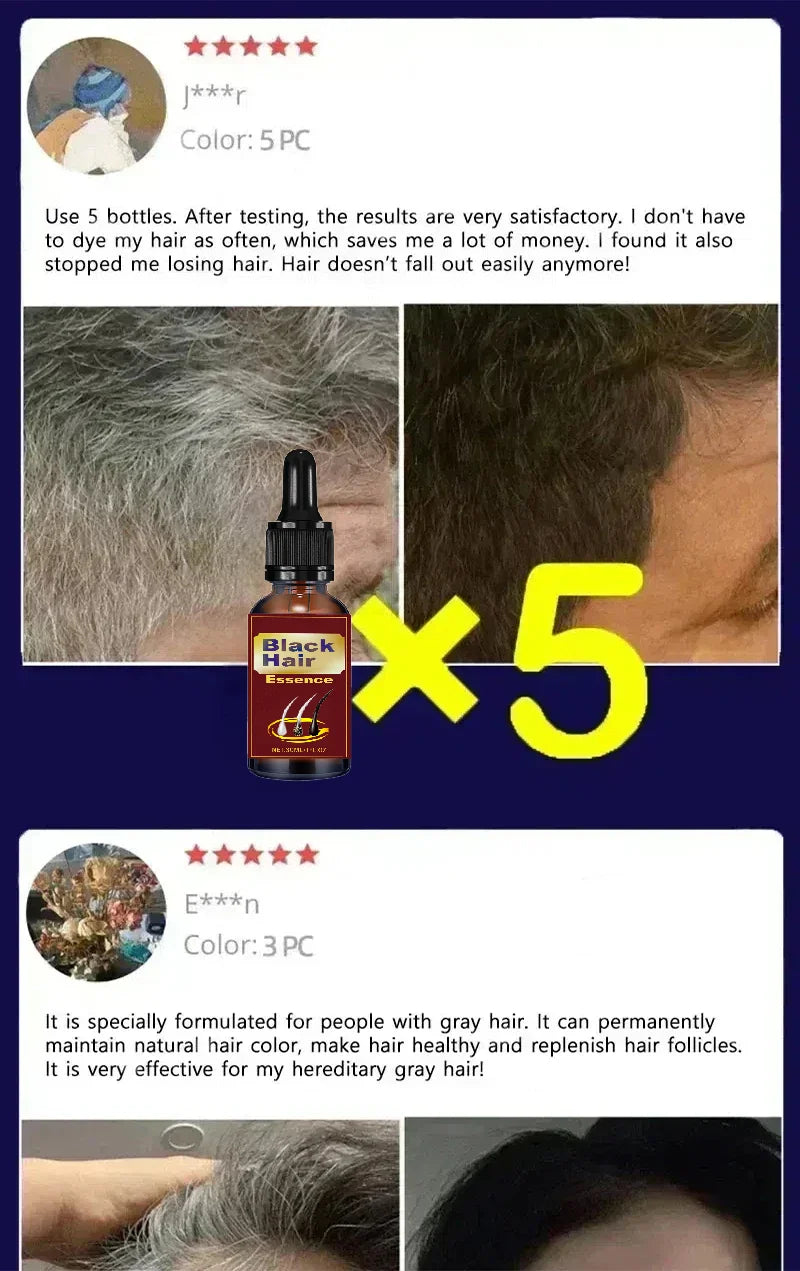 White Hair Killer – Gray Hair Restorer 2025