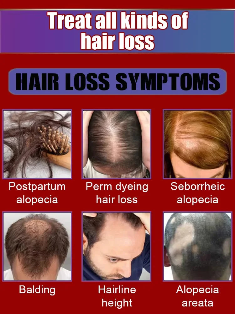 WPRBREGT Hair Growth Essential Oil