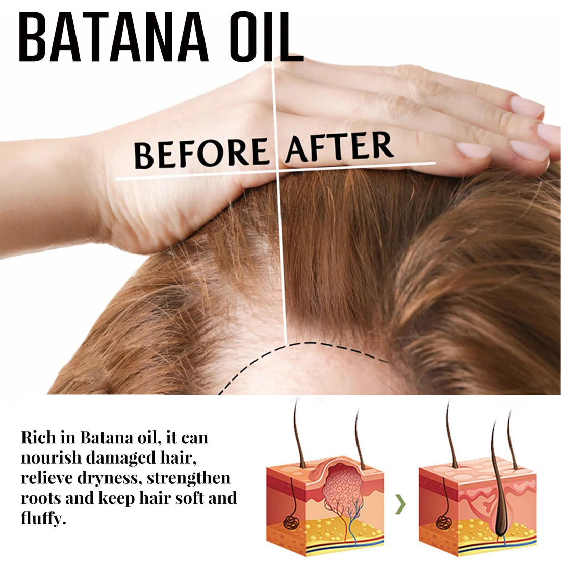 Fast Hair Growth Set – Batana Oil Treatment