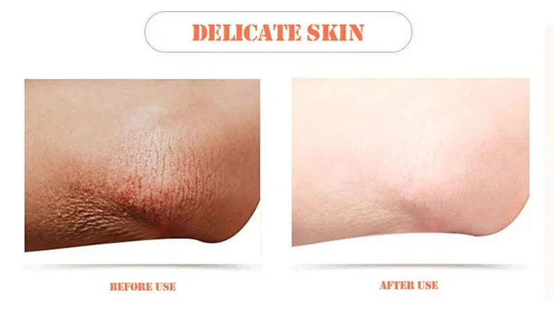 Body Whitening & Brightening Soap