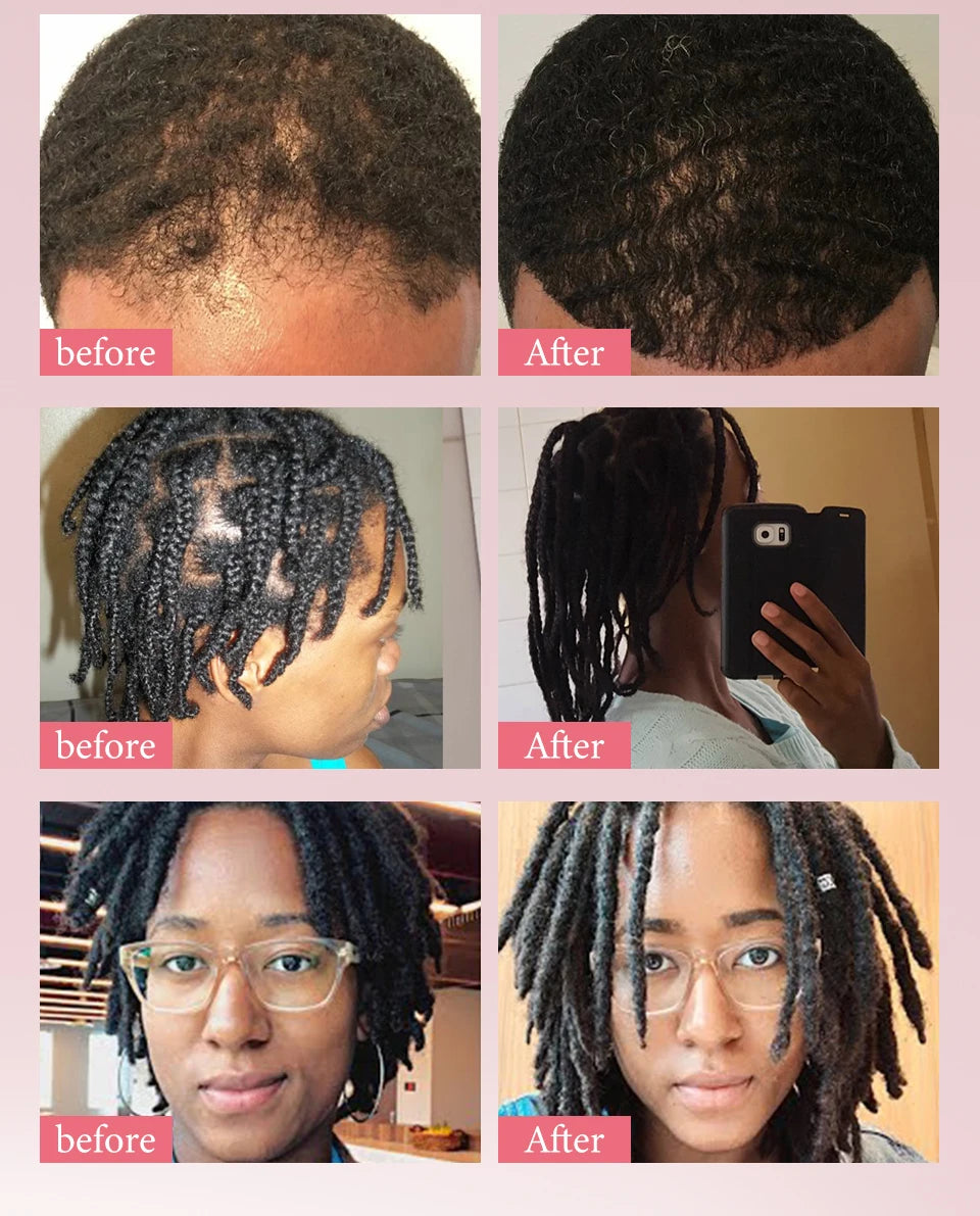 Fast Hair Growth Set – Batana Oil Treatment