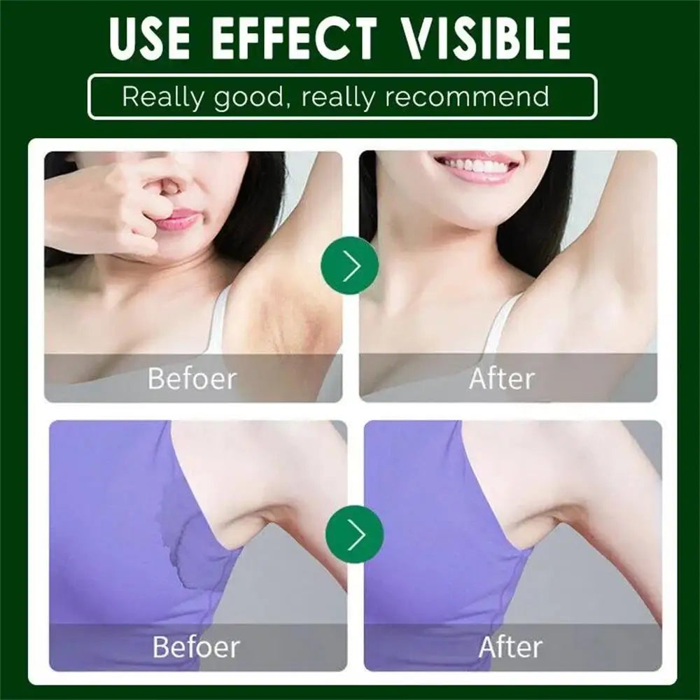 Underarm Odor Removal Cream