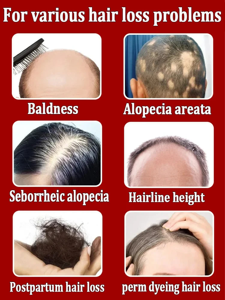 Hair Growth Solution – Fight Baldness & Hair Loss