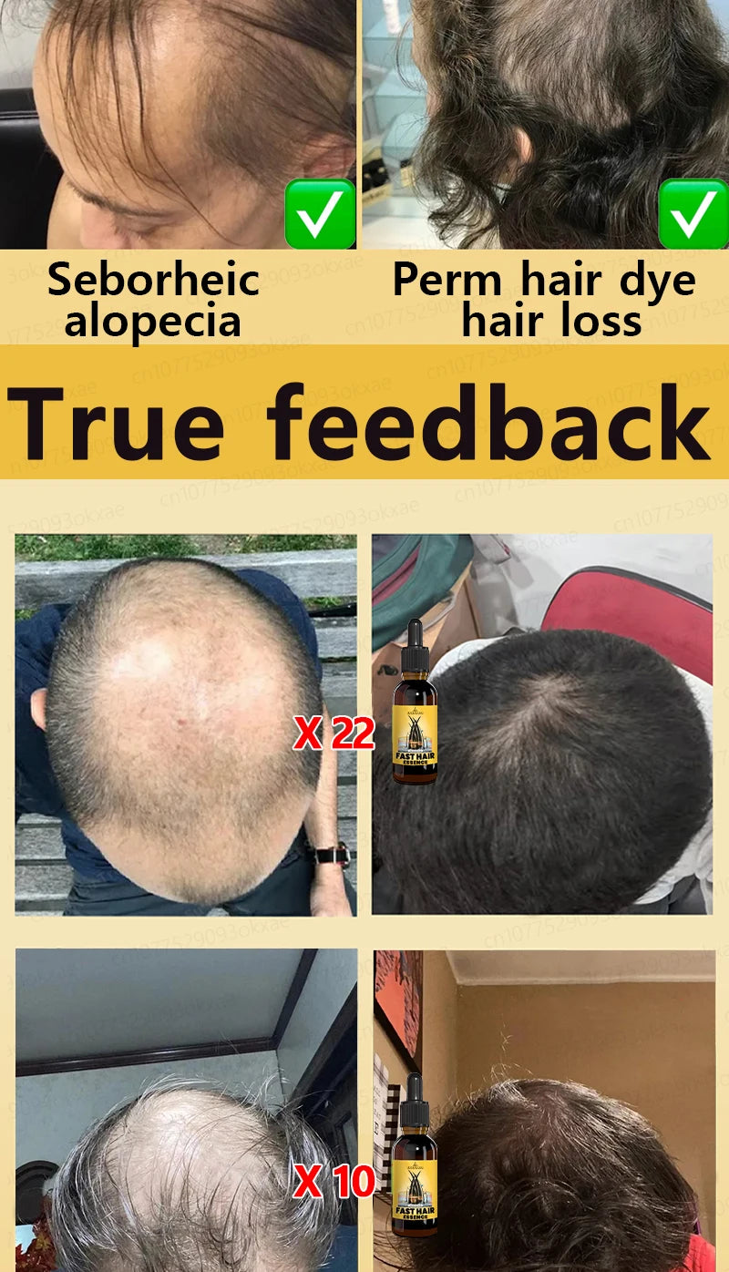 Hair Growth Solution – Fight Baldness & Hair Loss
