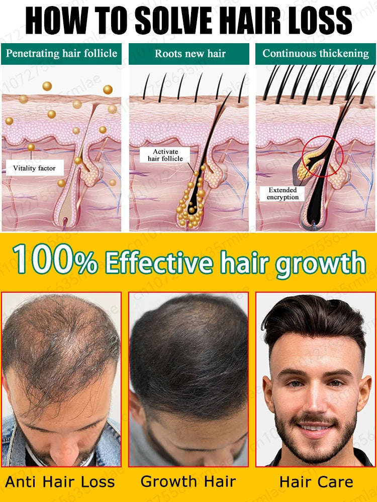 Hair Growth Solution – Fight Baldness & Hair Loss