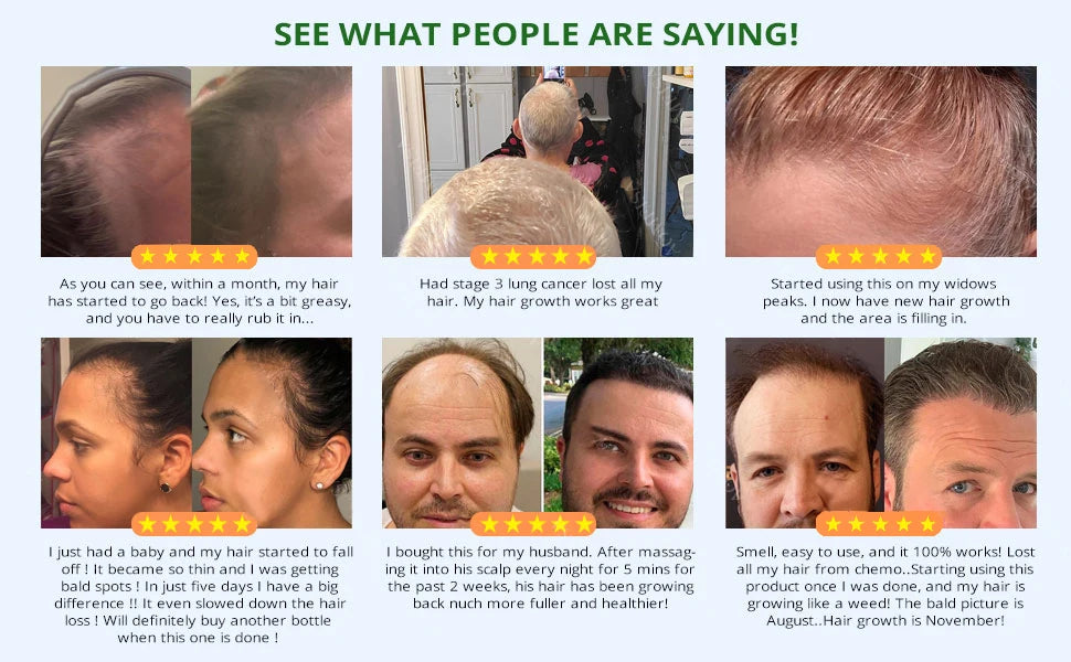 Fast Hair Growth Set – Batana Oil Treatment