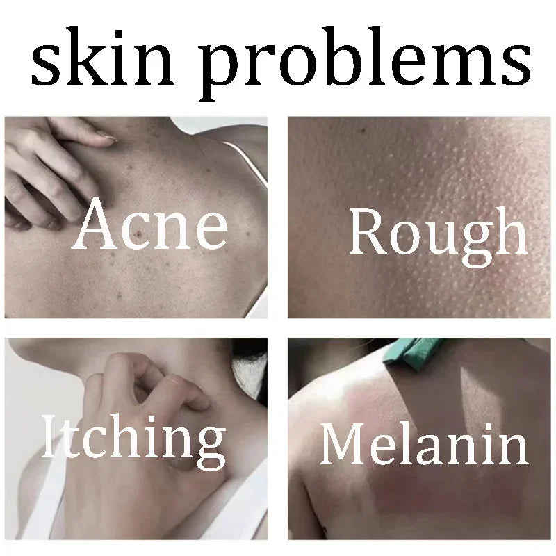 Body Whitening & Brightening Soap