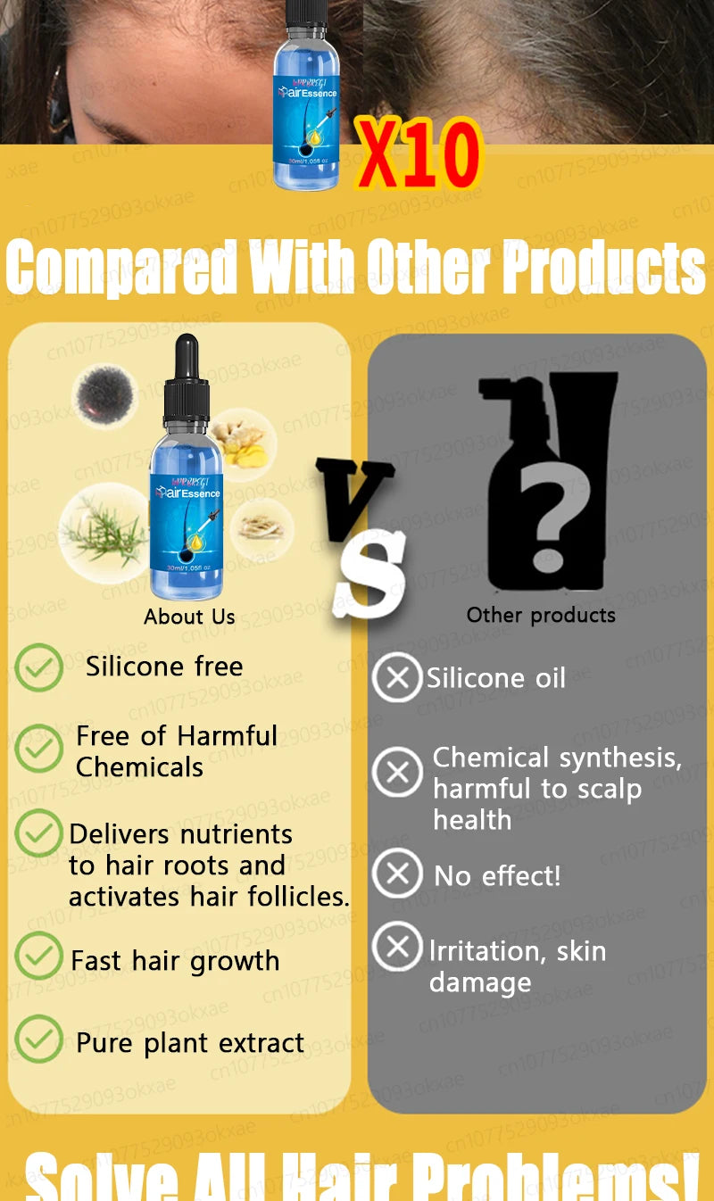WPRBREGT Hair Growth Essential Oil