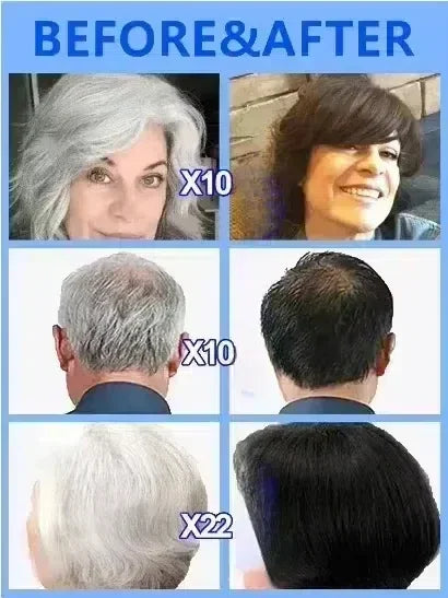 White Hair Killer – Gray Hair Restorer 2025