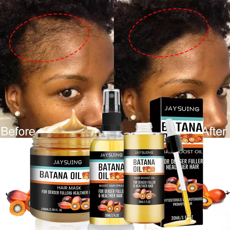 Fast Hair Growth Set – Batana Oil Treatment